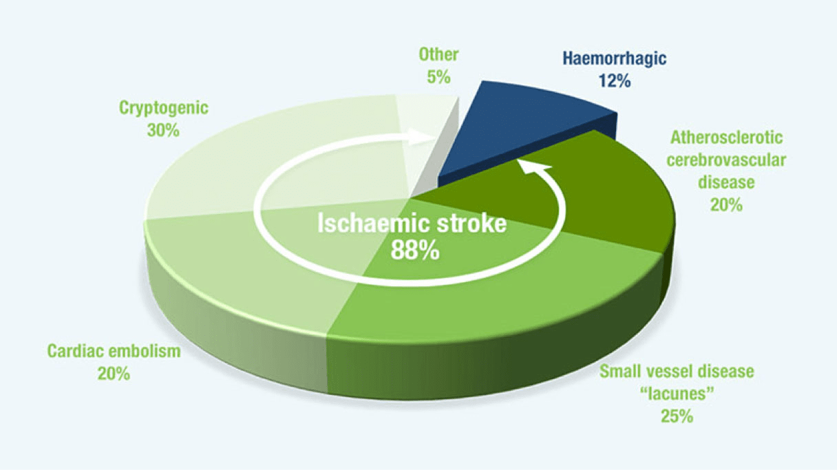 Classification of stroke