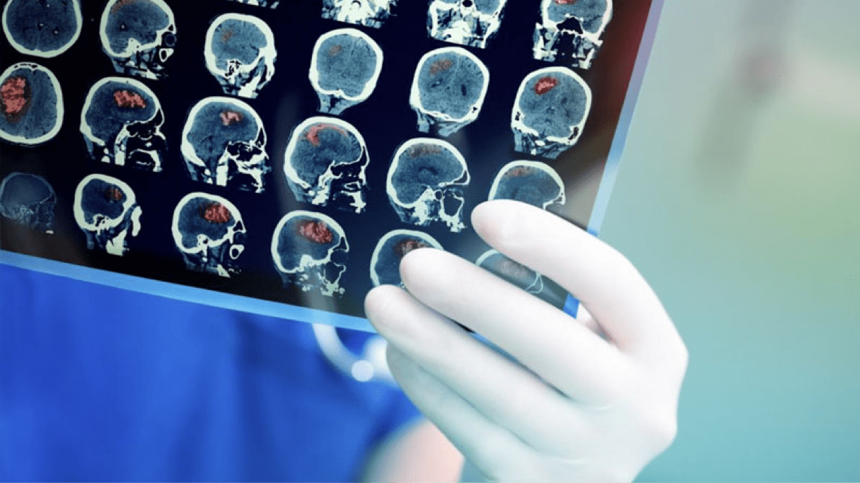 Rapid imaging is essential