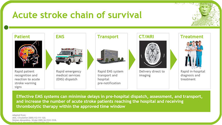 Management of acute ischaemic stroke (AIS) as an emergency